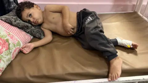 Tragic Aftermath: Gaza Children Await Vital Evacuations Amid Crisis