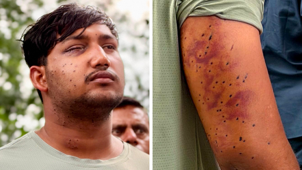 Pellet‑Gun Wounds Confirmed in Delhi Protest, Forensic Experts Say