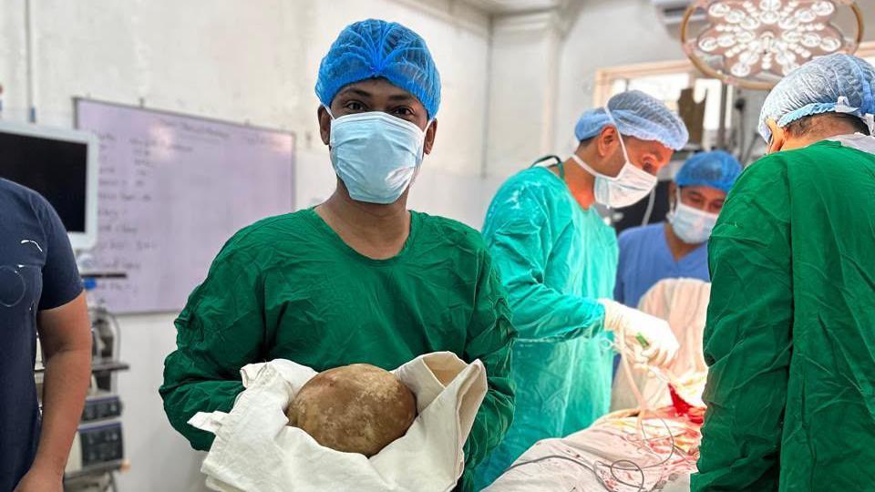 Sri Lanka surgeons claim record with 3.1kg bladder stone removal