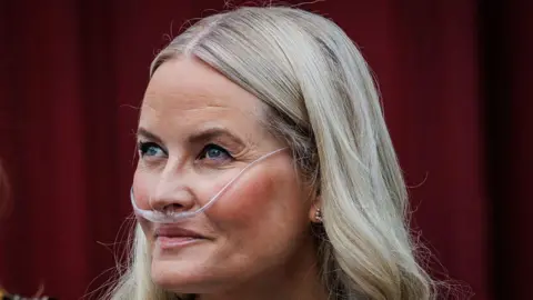 Norway's Crown Princess Mette‑Marit Receives Successful Lung Transplant